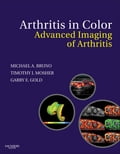 Arthritis in Color