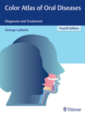 Color Atlas of Oral Diseases: Diagnosis and Treatment