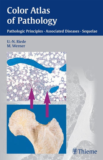 Color Atlas of Pathology: Pathologic Principles, Associated Diseases, Sequelae